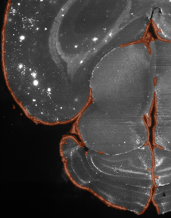 Slice of mouse brain, negative masked