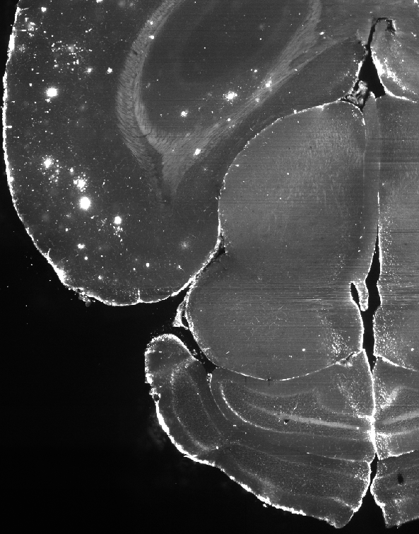 Slice of mouse brain, unsegmented